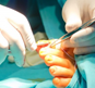 Cirugía Podológica